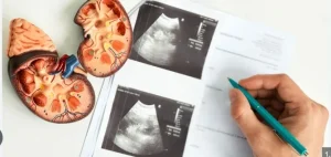 Diabetic Kidney Disease Screening